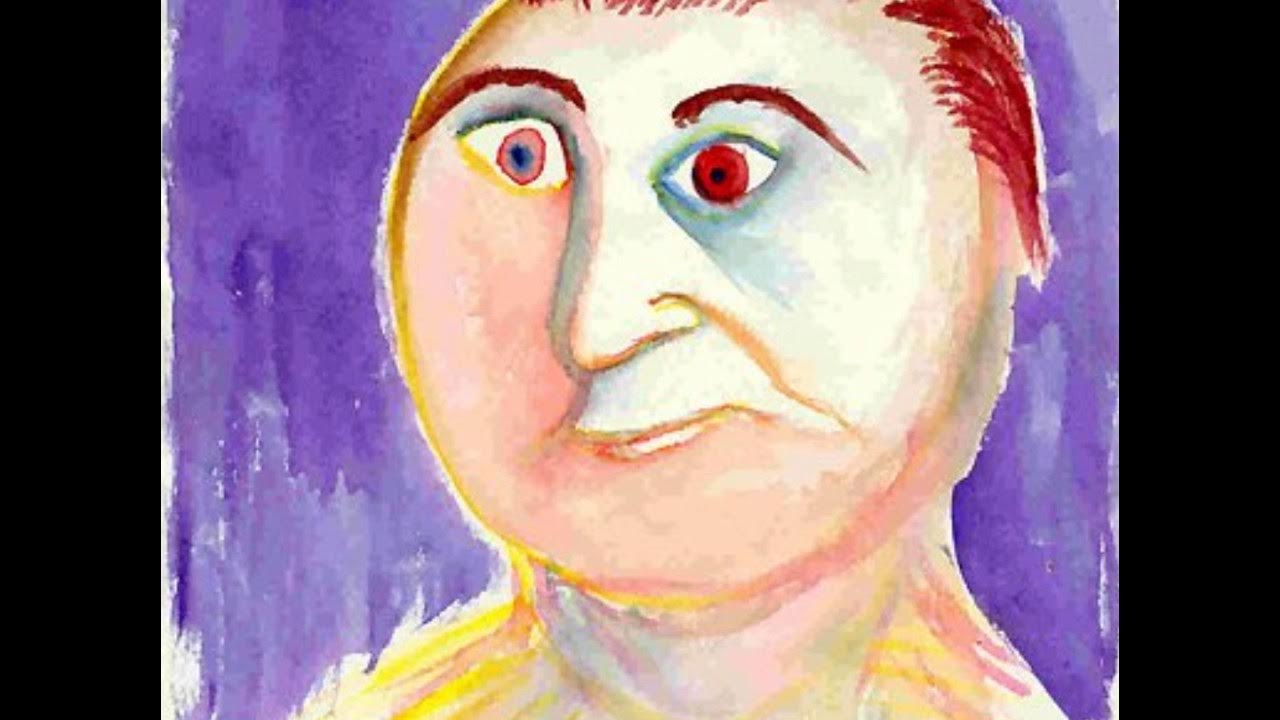 Степени дебильности. Олигофрен ребенок рисунок. Лицо олигофрена. Эпидемиология умственной отсталости. Обучение олигофренов детей.