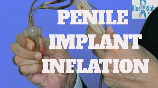 How To Inflate And Deflate A Penile Implant