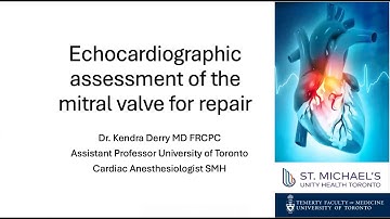Echocardiographic Assessment of the Mitral Valve for Repair