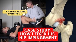 How I Fixed His Hip Impingement after many Physical Therapists couldn't (case study)