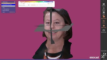 Import des données Modjaw dans exocad