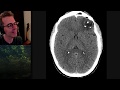 Isolation tutorial: Neuroradiology #2 with Frank Gaillard