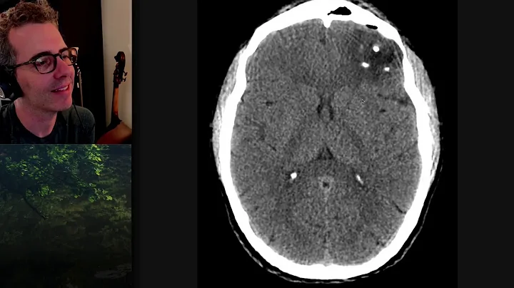 Isolation tutorial: Neuroradiology #2 with Frank Gaillard