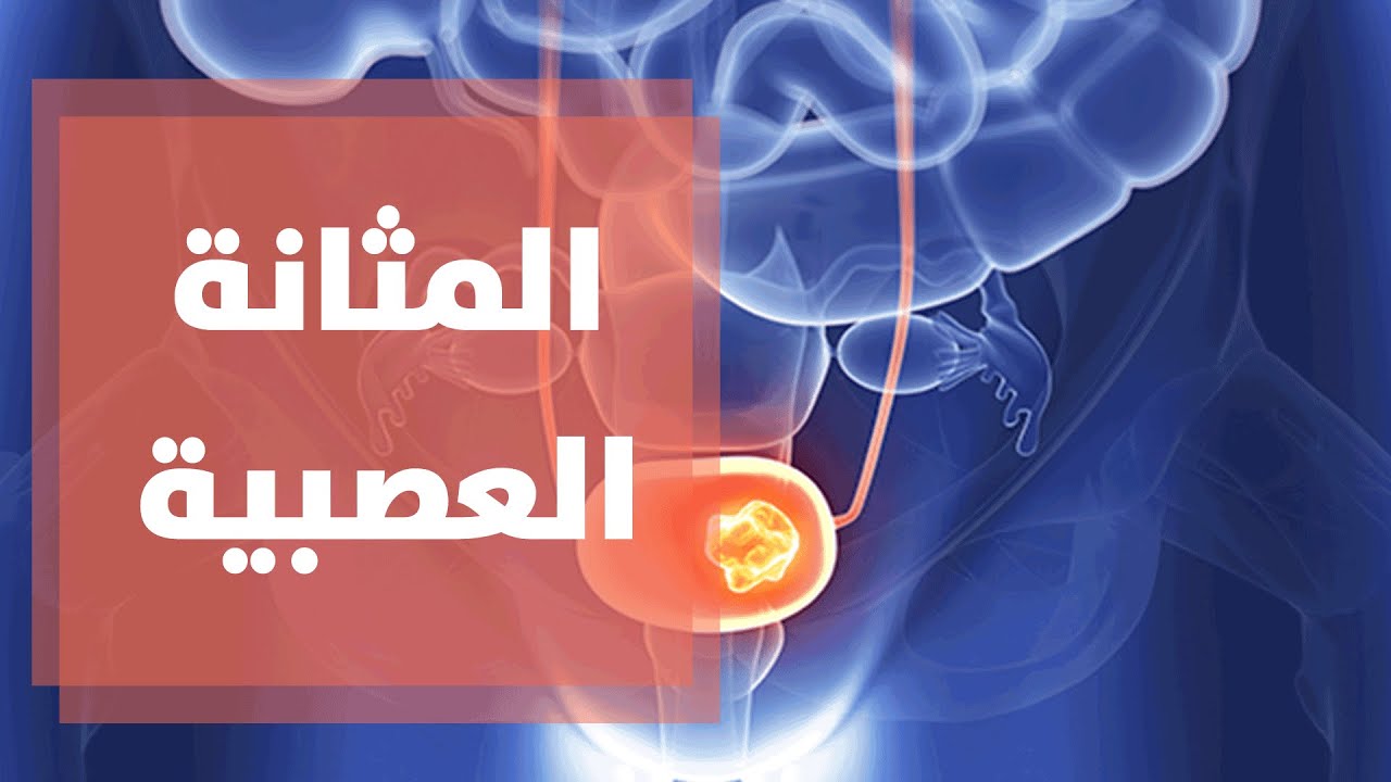 ما هي أسباب الإصابة بالمثانة العصبية؟