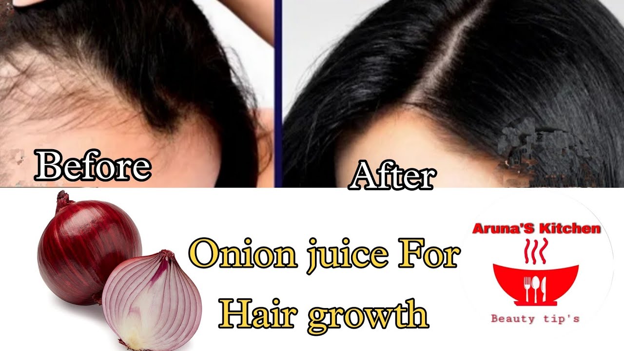 Onion Juice For Extreme Hair Growth /Make Onion Juice For Hair Without