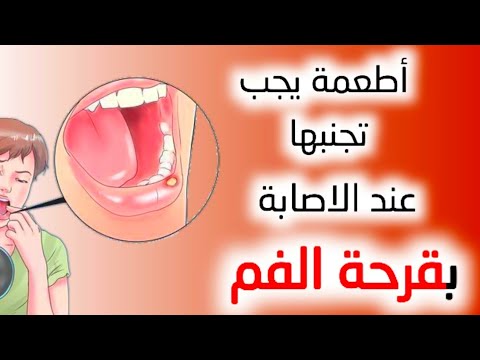 إذا كنت تعاني من تقرحات الفم تجنب هذه الأطعمة فهي تهيجها