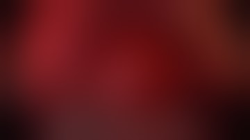 SA-56 laparoscopic partial nephrectomy - early unclamping - shortened - Serdar Aykan MD Assoc Prof