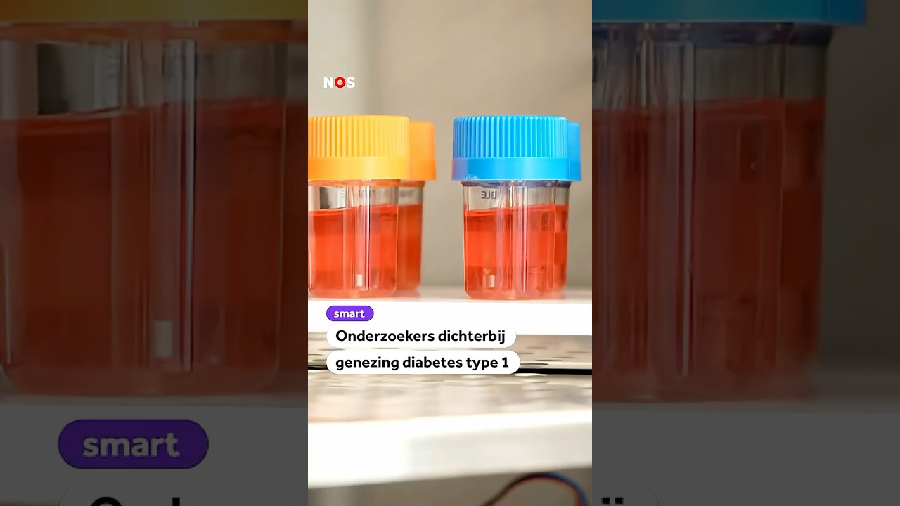 Onderzoekers dichterbij genezing diabetes type 1
