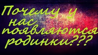 ПОЧЕМУ У НАС ПОЯВЛЯЮТСЯ РОДИНКИ! НЕТ ТАЙН!