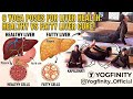 Can You Do This? 6 Poses to Reverse Fatty Liver! 🛡️🧘♀️ #yoga #fattyliver #liver #yogapose
