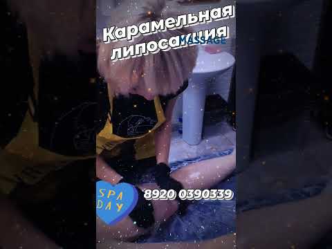 процедура карамельная липосакция