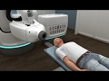 #CyberKnife Brain Tumor Animation