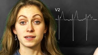 ECG: The precordial/chest leads V1,...,V6