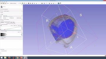 Volume clipping (cropping) with Model on Slicer 3D