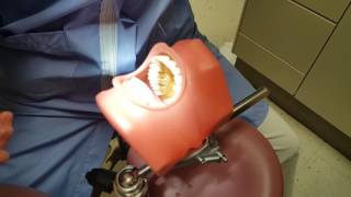 Tips on using a Barnhart universal