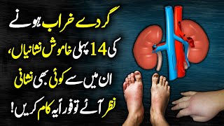 14 Kidney Failure Symptoms - Kidney Disease Symptoms Urdu Hindi