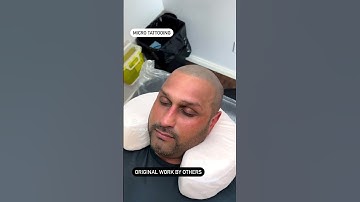 Scalp micropigmentation repair or correction. SMP #scalpmicro #scalpmicropigmentation