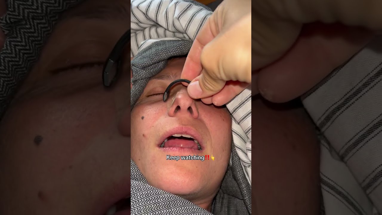 This Magnetic Nose Strip Can Change Your Life Snoring Magneticnosestrips Snoringhusband