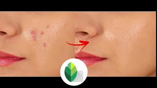 How To Remove Pimples Editing With Snapseed App Easy Method screenshot 3