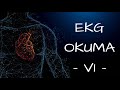 EKG KURSU / Ventriküler Ritimler