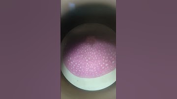 Epithelial tissue under microscope