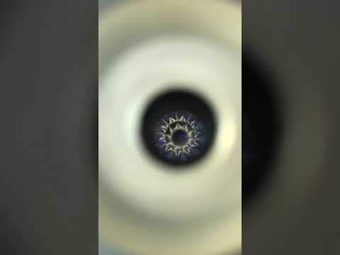 When The Diamond Under The Microscope