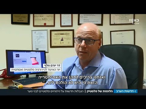 וִידֵאוֹ: אייזה אנוקינה חשפה את כל סודות הניתוחים הפלסטיים וסיפרה כיצד שינתה את פניה וגופה