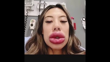 Wait for end 😂😂 #funny #fails #failarmy #shorts