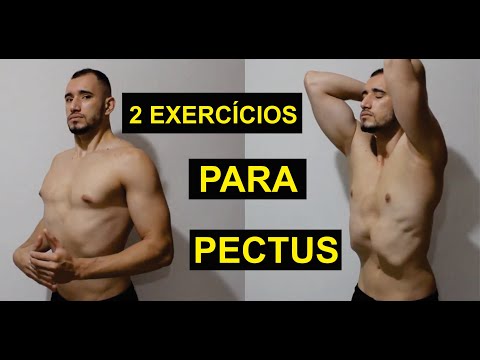 Vídeo: Exercícios Para O Pectus Excavatum: Melhorar A Força