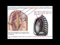 Pleura damaging syndrome