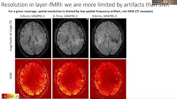 Latest developments in the field of layer-fMRI VASO -- Dr. Laurentius (Renzo) Huber, Ph.D.