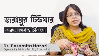 জরায়ুর টিউমারের লক্ষণ ও চিকিৎসা || Uterine Fibroids symptoms and treatments in Bangla