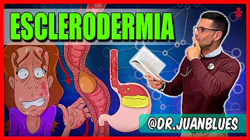 ¿Cómo diagnostica un médico la esclerodermia?