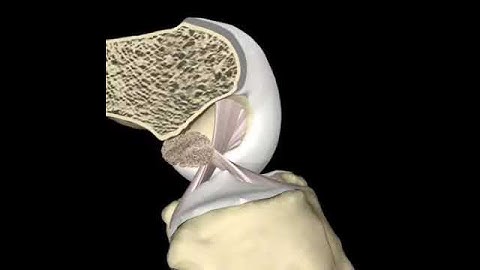 The ACL During Knee Range of Motion