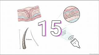 What diagnostic tools (e.g., vaginal biothesiometry, high-frequency pelvic ... | WHC Clinical FAQ