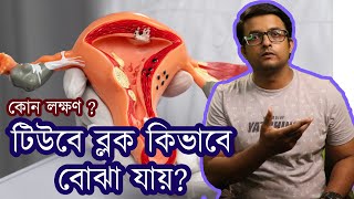 ফ্যালোপিয়ান টিউবে ব্লক আছে কি করে বোঝা যায় | Symptoms | Fallopian tube block | The Bong Parenting