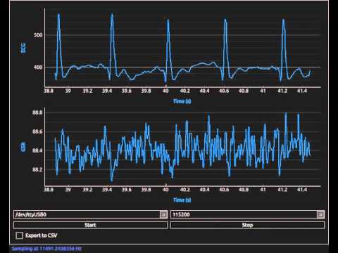 Arduino Based - Python eHealth Application