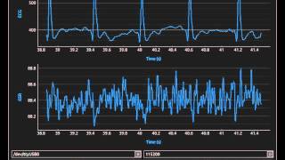 Arduino Based - Python eHealth Application