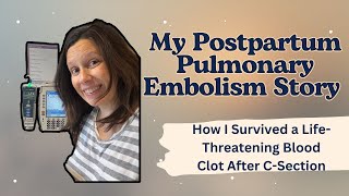 My Postpartum Pulmonary Embolism Story. How I Survived a Life-Threatening Blood Clot After C-Section Net Worth
