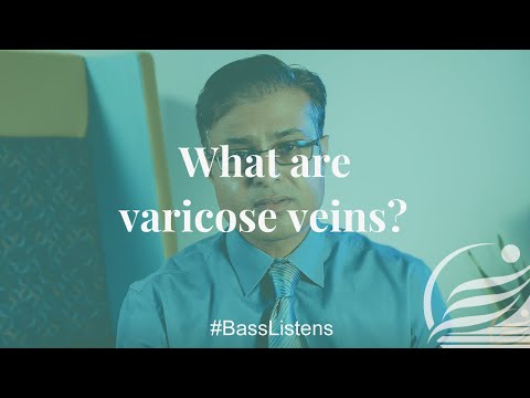 What are Varicose Veins? video thumbnail