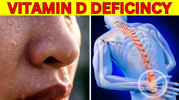 9 Alarming Signs of Vitamin D Deficiency You Should Never Ignore!