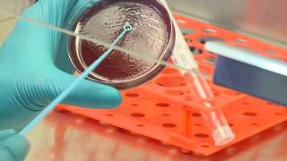 Requerimientos Mínimos Para La Confirmación De Difteria En Laboratorio