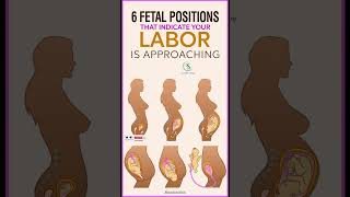 6 Fetal Positions That Indicate Your Labor Is Approaching pregnancy pregnancycare pregnancy