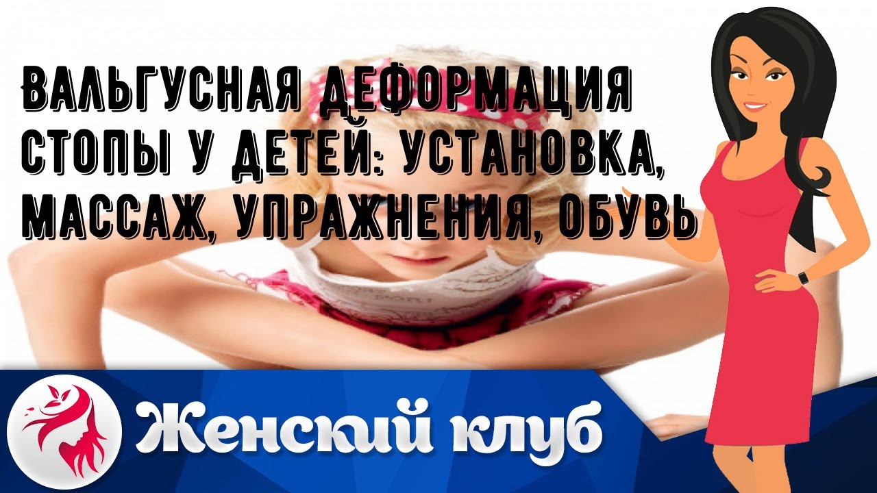 Вальгусная деформация стопы у детей: установка, массаж, упражнения ...