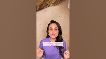 Back acne | how to treat | what to avoid