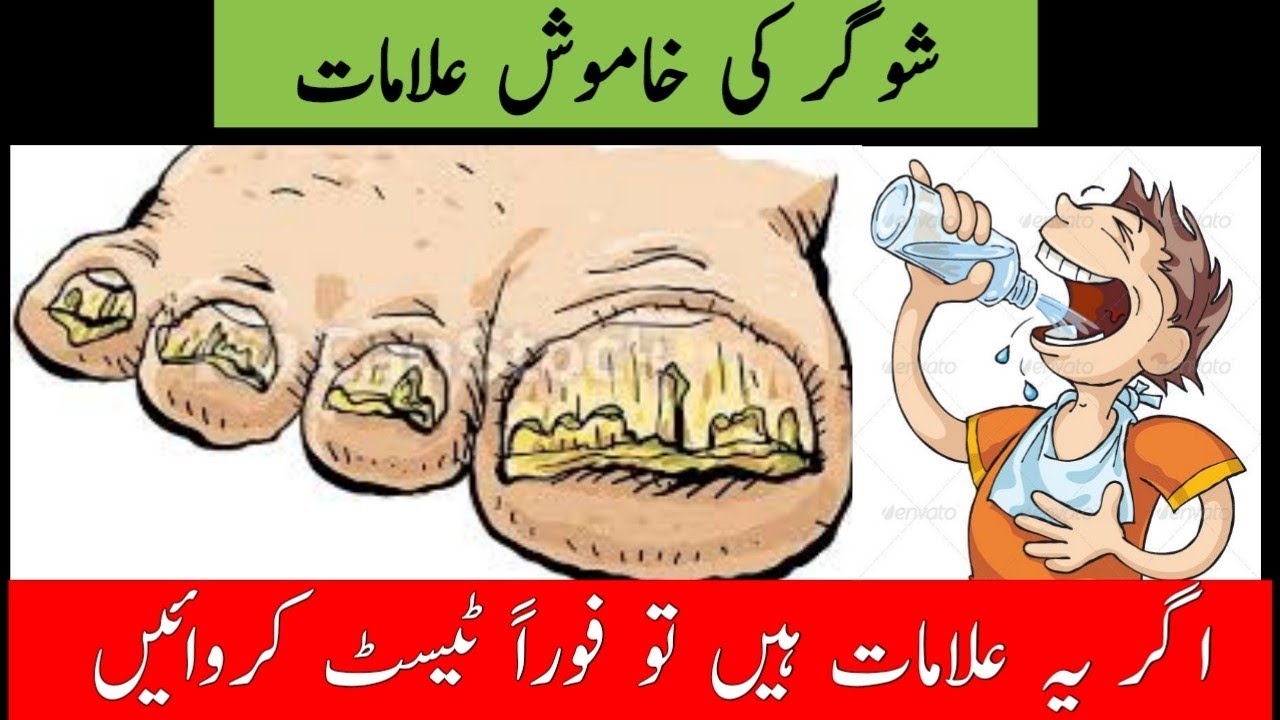  Diabetes symptoms in urdu sugar ki alamat मधुमेह के लक्षण