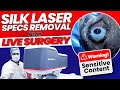 Silk laser specs removal  near live surgery by dr rahil chaudhary