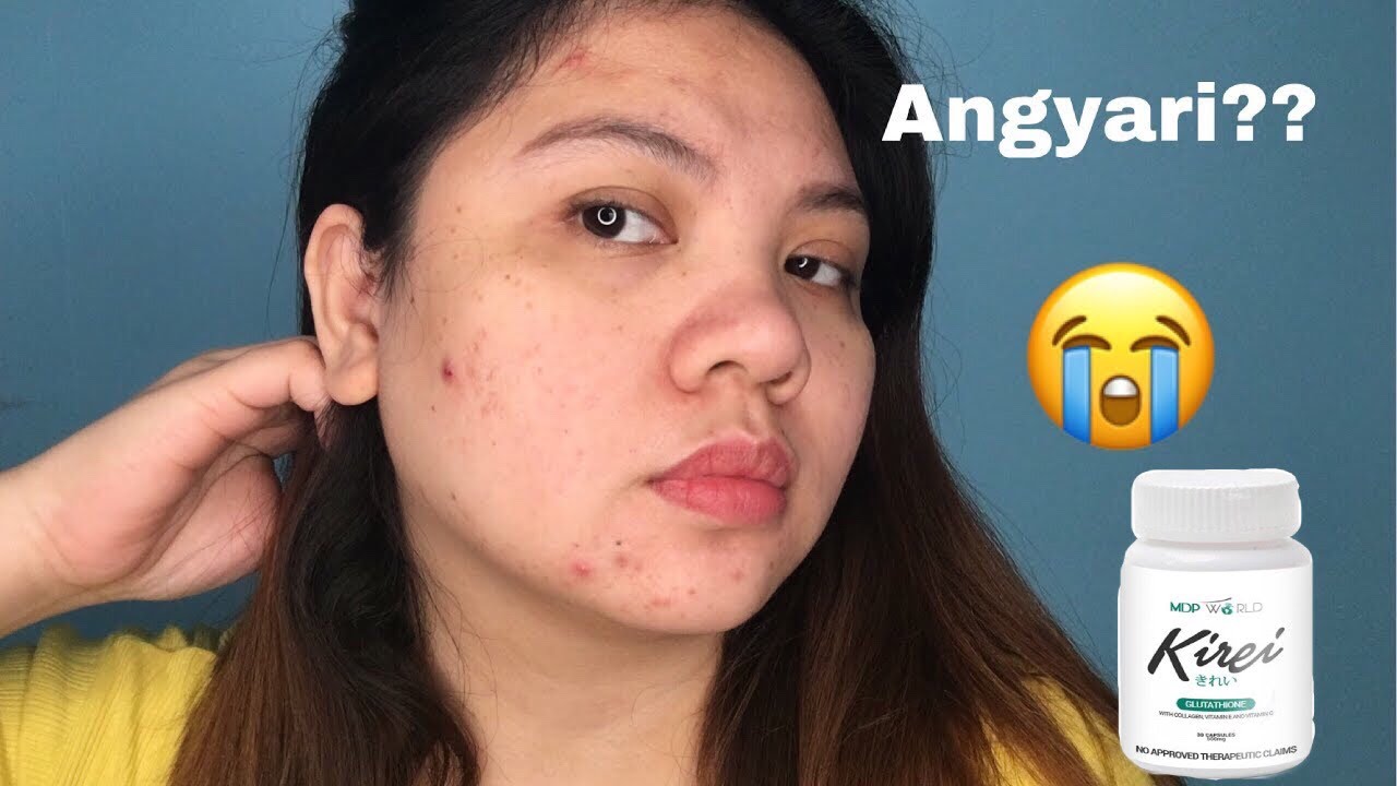 kirei glutathione video BAKIT NAG-KAGANON?? FINAL REVIEW: || MAKAKAPUTI BA TALAGA? || AJ PARMA InfiniWell BPC RAPID PRO warning-ca Size:30 gummies