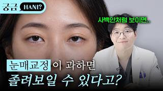 눈매교정이 과하면 졸려보일까 쇼츠