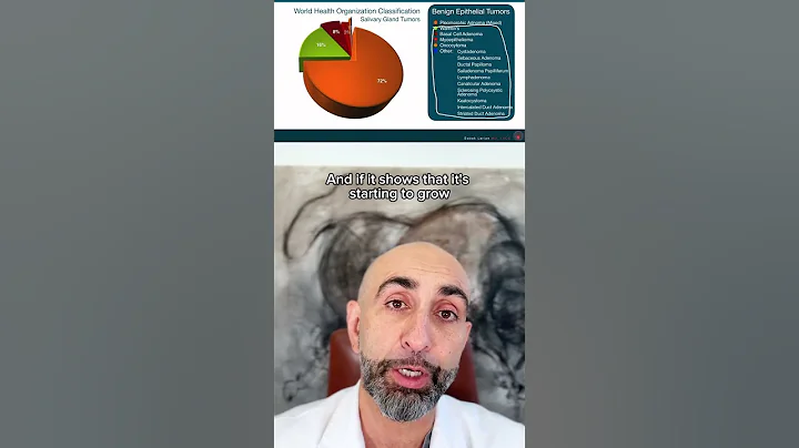 Do all parotid tumors need to be treated with surgery?